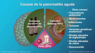 Pancreatitis aguda [upl. by Novonod]