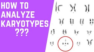 How to Analyze Karyotypes 101 [upl. by Marmaduke]