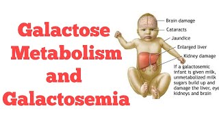 Galactose metabolism  Biochemistry [upl. by Philipson685]