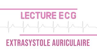 Interprétation ECG  Extrasystole Auriculaire quotESAquot [upl. by Ausoj153]