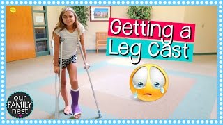 GETTING A LEG CAST FOR BROKEN FOOT  DANCE INJURY [upl. by Inahpets360]