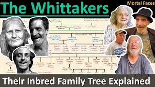 THE WHITTAKERS A West Virginia Inbred Family Tree Explained Mortal Faces [upl. by Fiora]