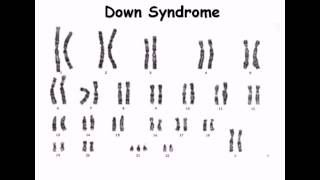 8 Karyotype [upl. by Michele]