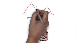 JVP waveform explained [upl. by Bury]