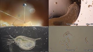 The Amazing Microscopic World [upl. by Sokcin]