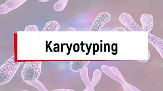 What is Karyotyping Test or Chromosomal Analysis [upl. by Rosecan]