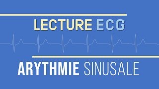 Interprétation ECG  Arythmie Sinusale [upl. by Virendra402]